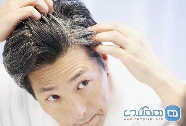 کندن موهای سفید باعث زیاد شدن آنها می شود؟ کندن موهای سفید باعث زیاد شدن آنها می گردد؟
