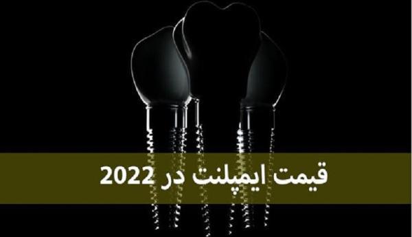 قیمت ایمپلنت دندان در سال 2022