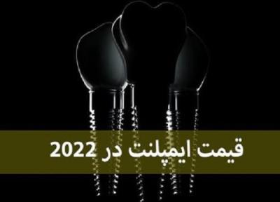 قیمت ایمپلنت دندان در سال 2022